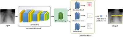 AI-CenterNet CXR: An artificial intelligence (AI) enabled system for localization and classification of chest X-ray disease
